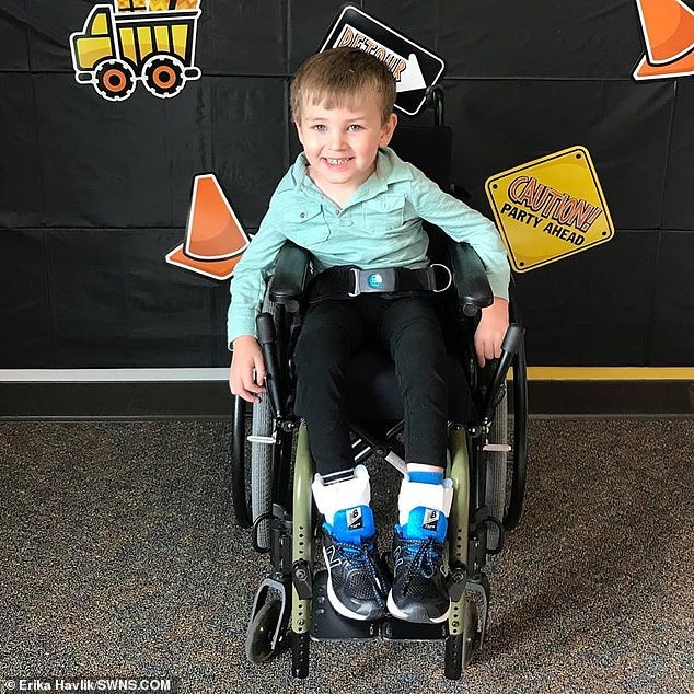 Bệnh não hiếm gặp ảnh 1 Benh nao hiem gap anh 1