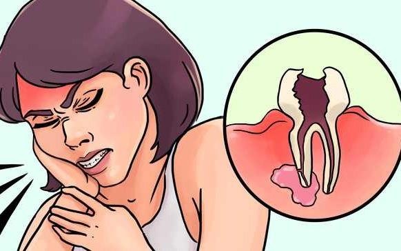 10 cach hieu qua giup ban 'chong choi' voi con dau khi moc rang khon hinh anh