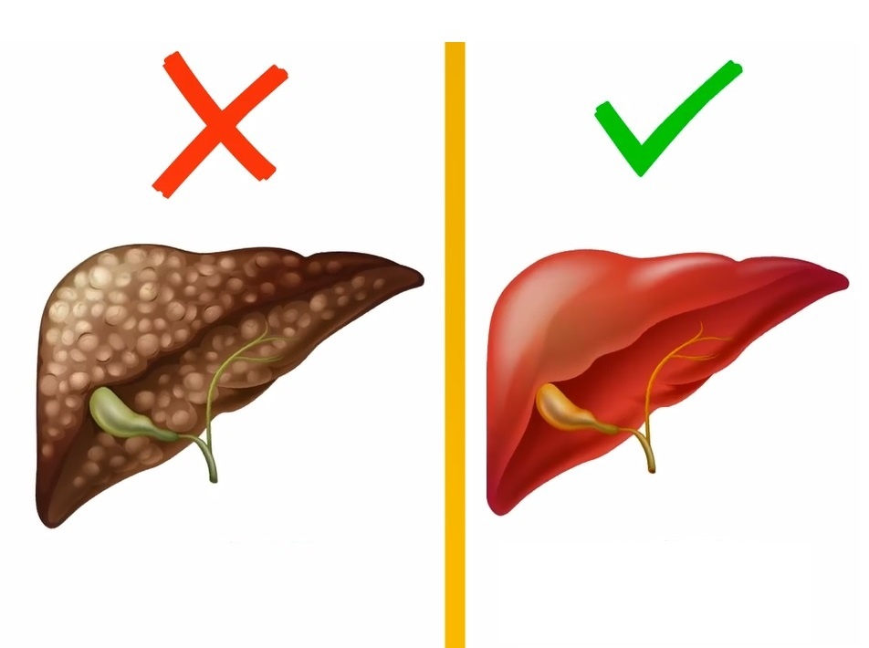 Cach thanh loc gan hieu qua trong hai tuan hinh anh