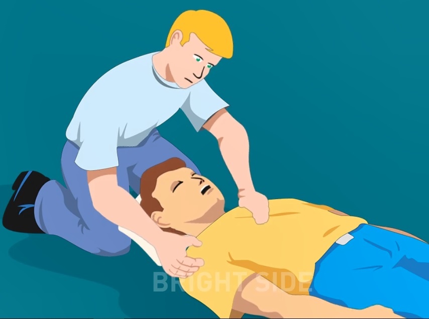 Cach so cuu kip thoi nguoi bi co giat, dong kinh hinh anh