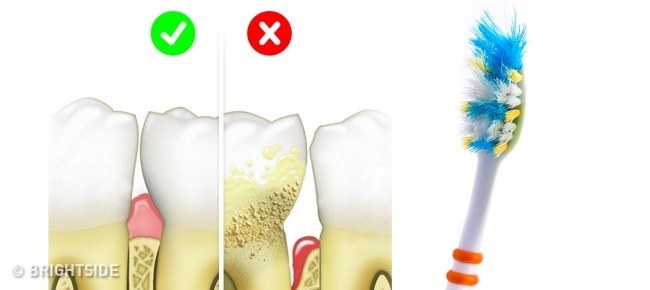 Thoi quen sai lam khi cham soc rang mieng anh 7