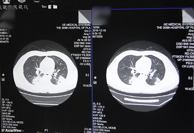 Ngui tat ban moi ngay anh 1