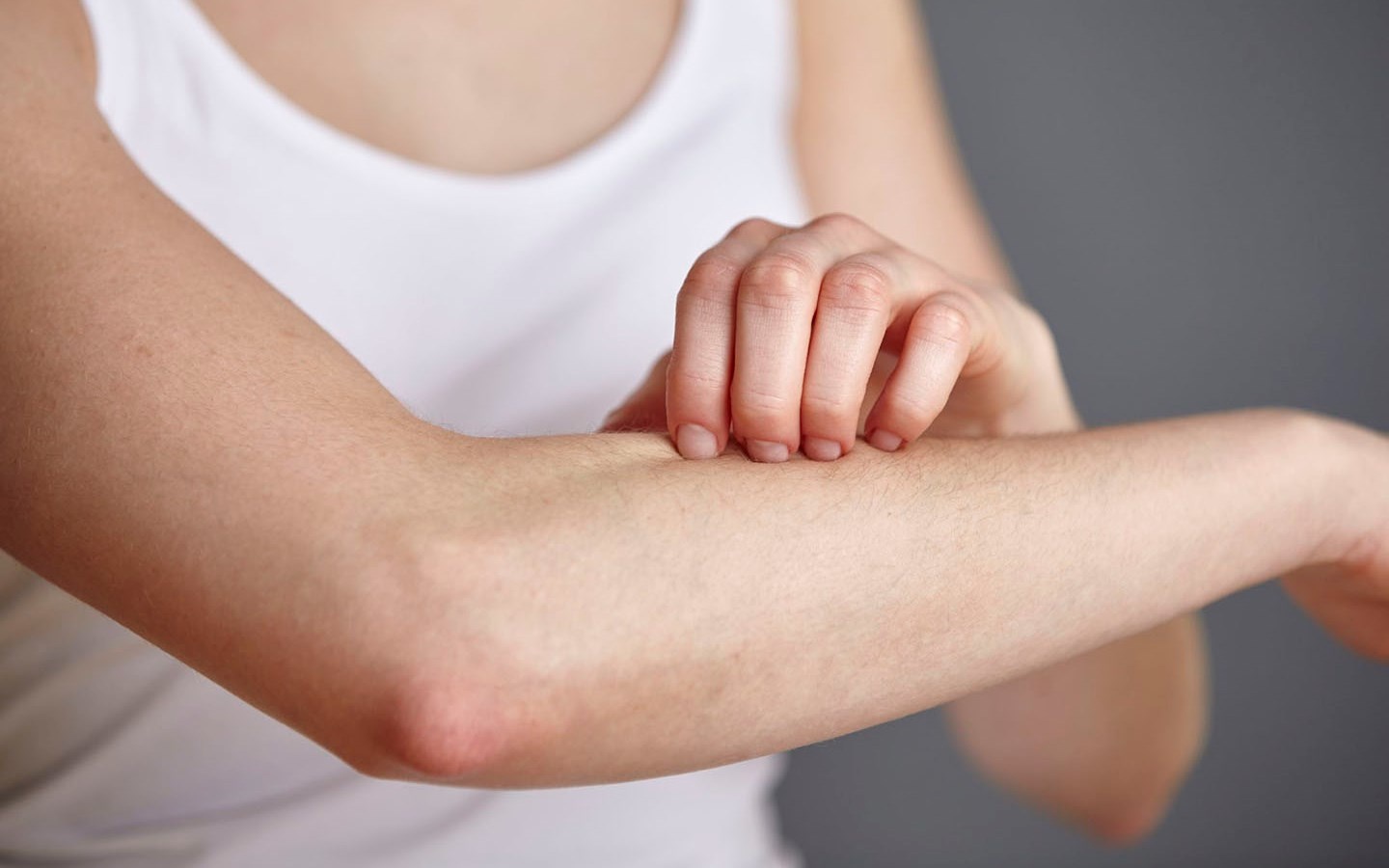 Cach nhan biet va so cuu khi bi di ung hinh anh