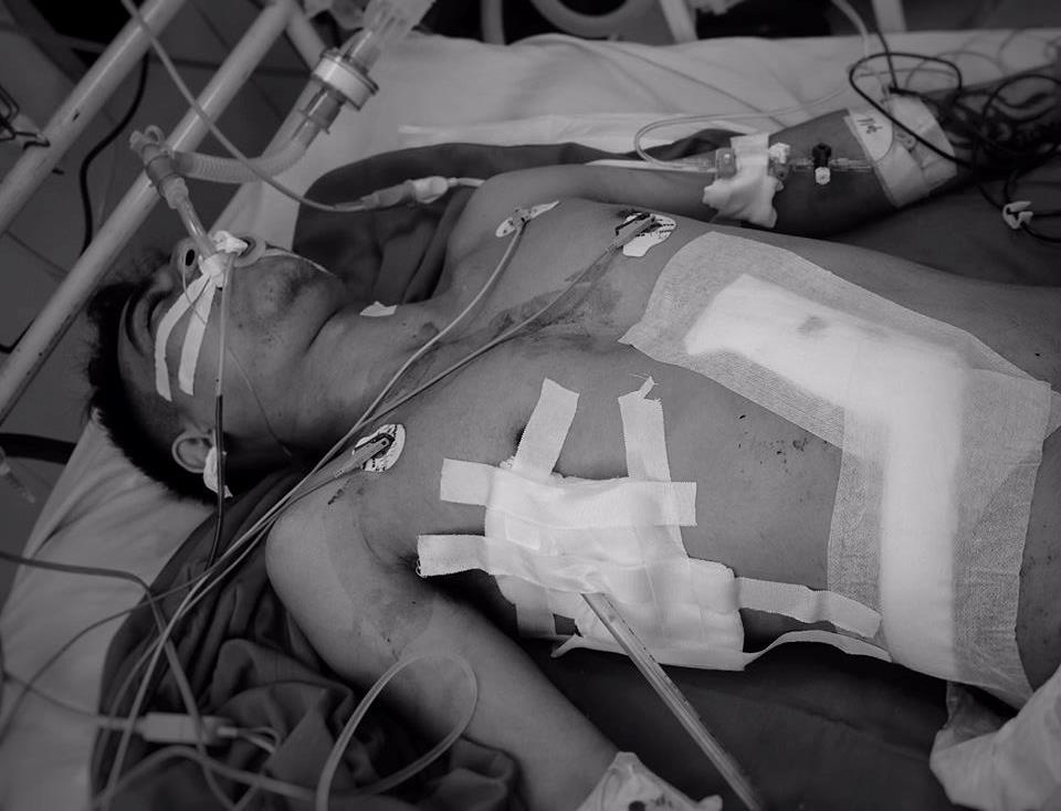 Bệnh nhân bị thủng tim, gan ảnh 1 Benh nhan bi thung tim, gan anh 1