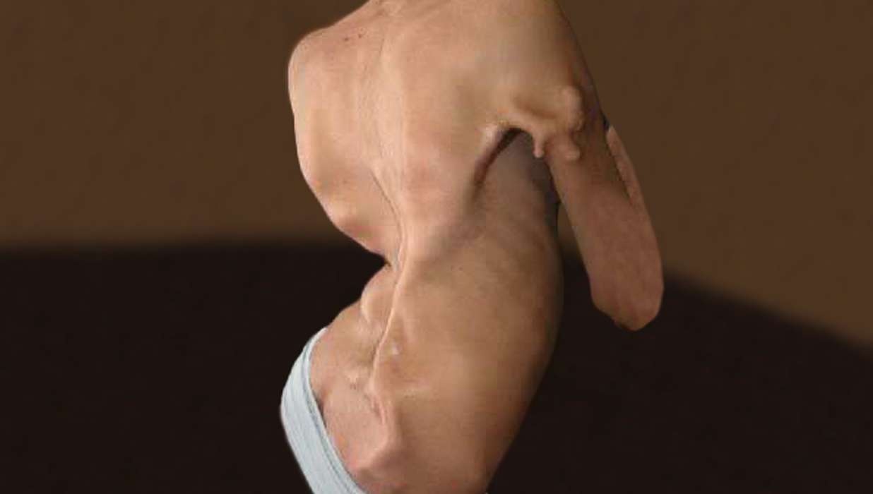 Can benh hiem,  ky la anh 8