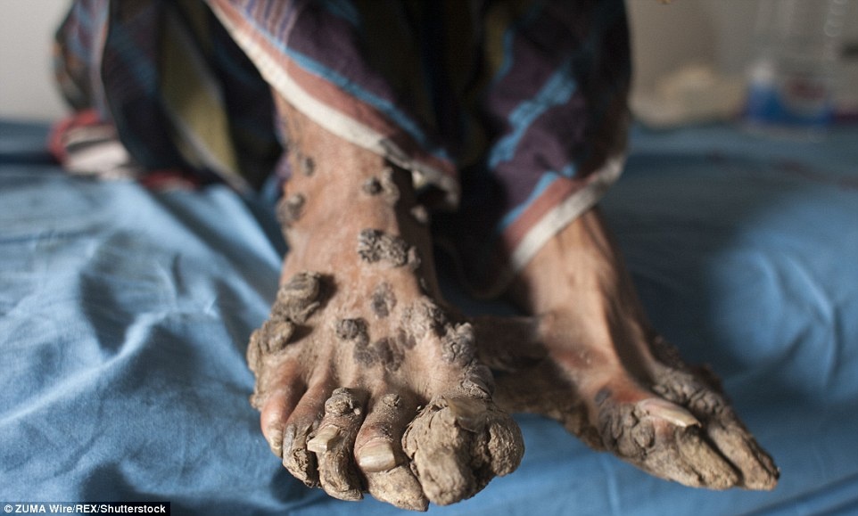 Can benh hiem,  ky la anh 9