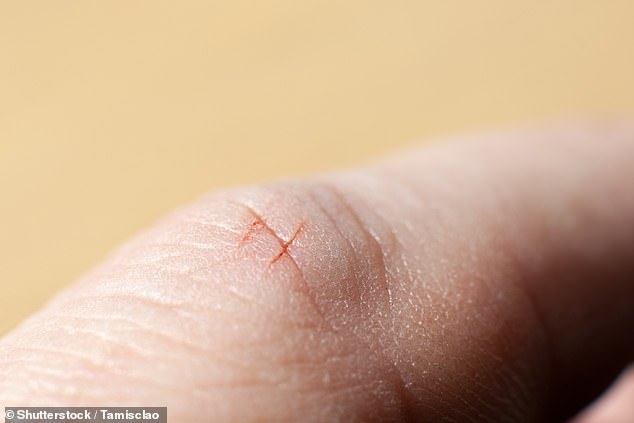 Giấy cắt vào tay gây đau đớn ảnh 1 Giay cat vao tay gay dau don anh 1