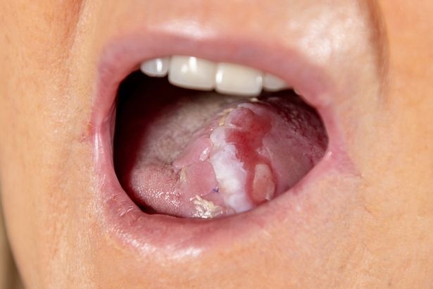 Tao luoi moi tu da tay anh 1