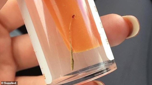 Co moc trong tai anh 1