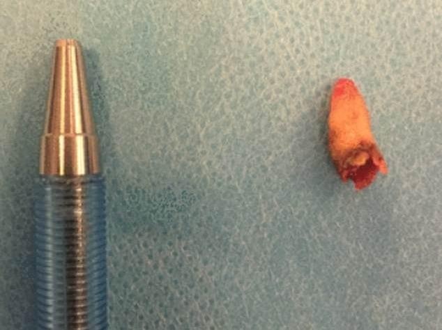 Nguoi dan ong moc rang trong mui hinh anh