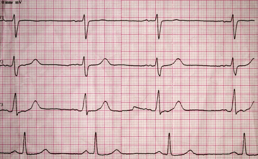 Van de suc khoe gay kho ngu anh 2