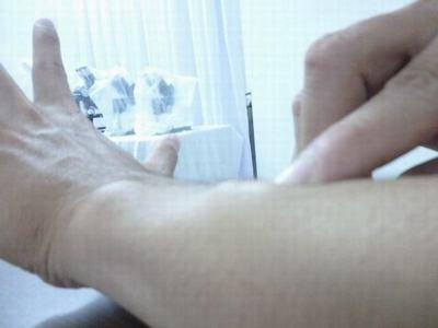 Benh san day lon anh 1