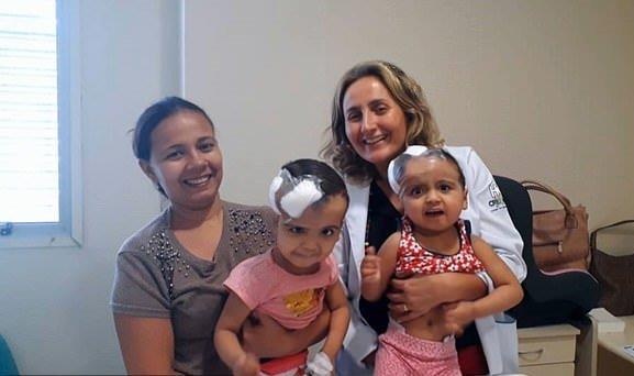 Cặp song sinh dính liền đầu ở Brazil ảnh 2 Cap song sinh dinh lien dau o Brazil anh 2