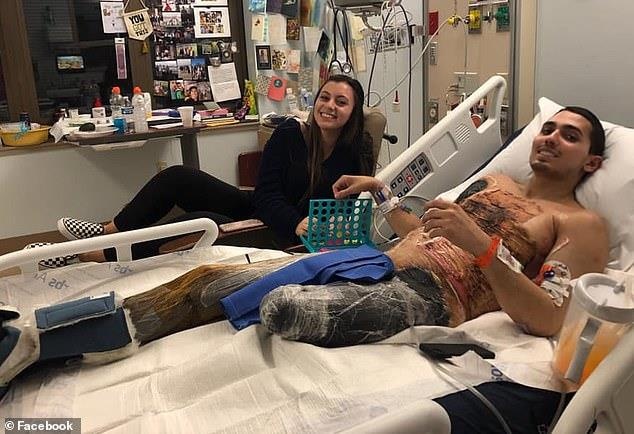 Mat chan trai vi nhiem vi khuan an thit nguoi hinh anh