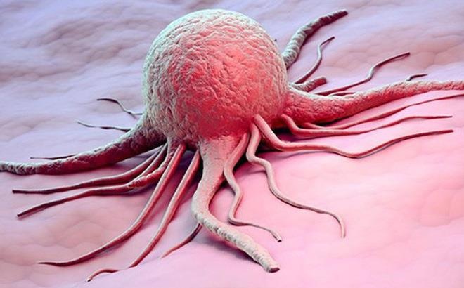 Tru tri chua Ba Vang: 'Ung thu la do oan hon trong tien kiep bao oan' hinh anh