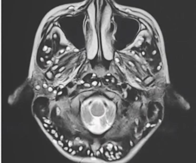 Thieu nien thiet mang vi san xo mit lam to trong nao hinh anh