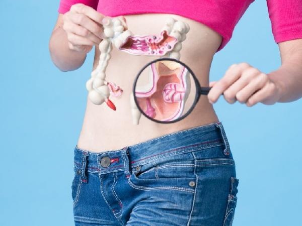 Dấu hiệu ung thư đại trực tràng ảnh 2 Dau hieu ung thu dai truc trang anh 2