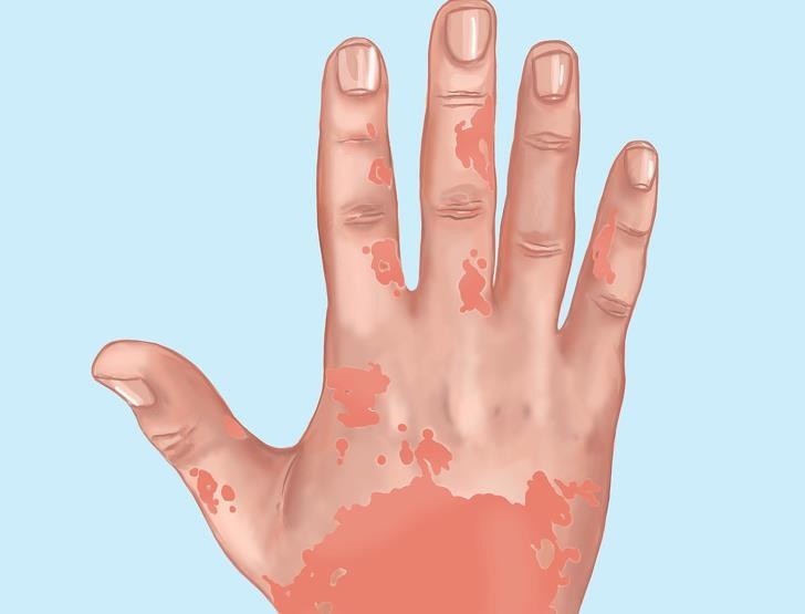 Dau hieu co the nhieu doc to anh 5