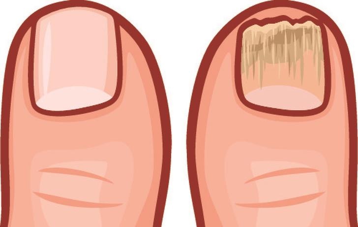 Dau hieu co the nhieu doc to anh 8