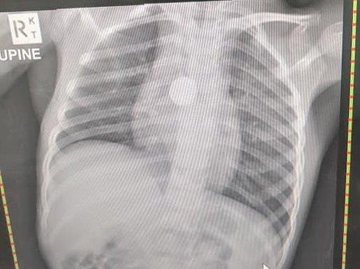 Cuc pin mac trong co hong anh 1