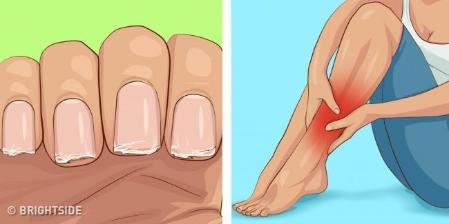 Tac hai khi uong nuoc ngot hang ngay anh 1