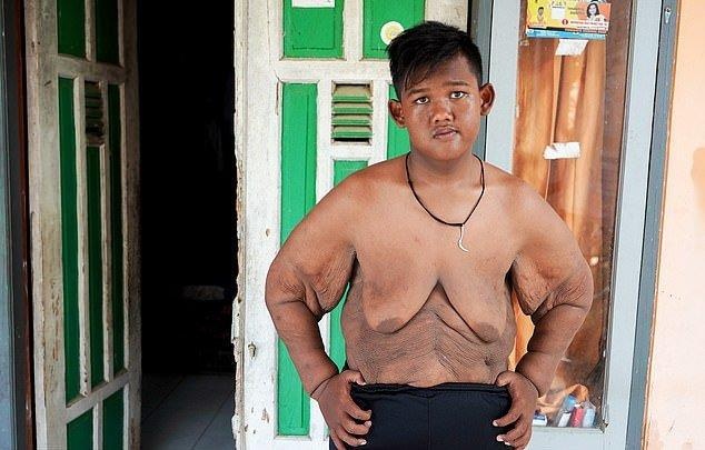 Cau be nang nhat the gioi giam can anh 11