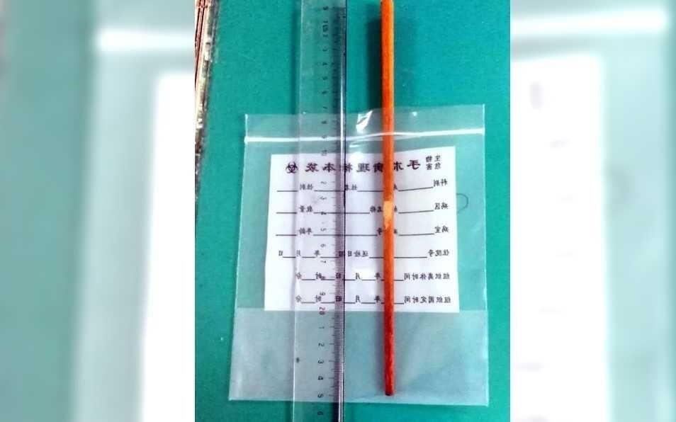 Be 3 tuoi bi dua dam vao hong xuyen so 10 cm hinh anh