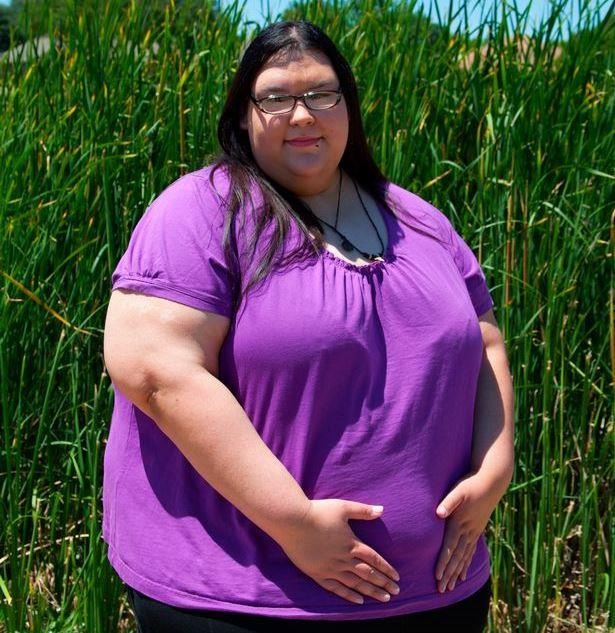 Nguoi phu nu nang 317 kg giam can anh 7