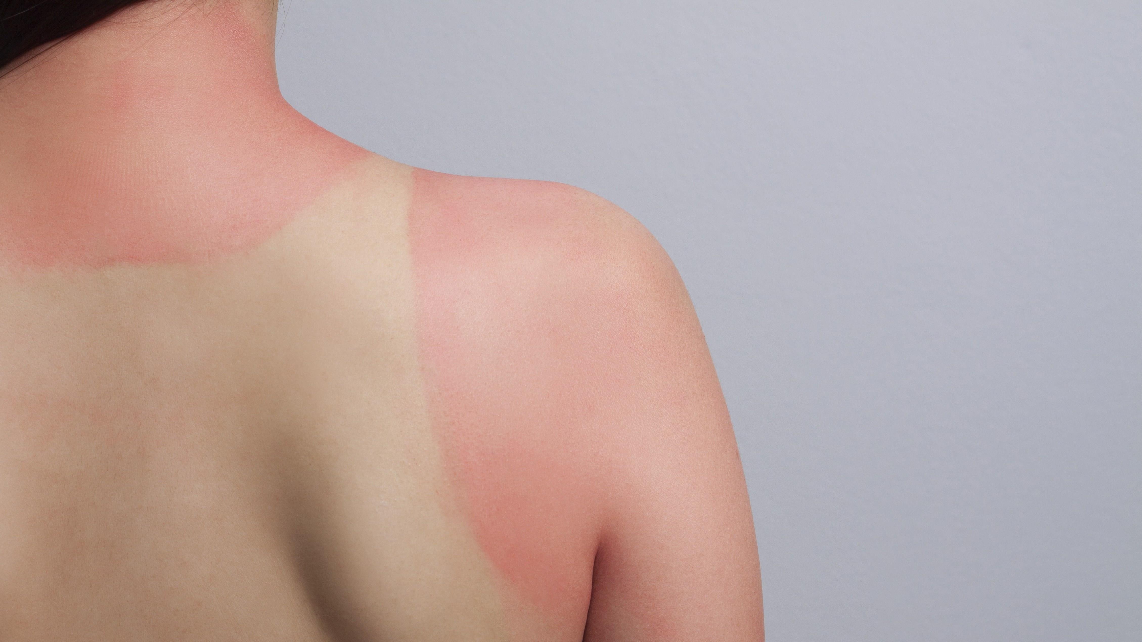 Van de suc khoe khi nang nong anh 1