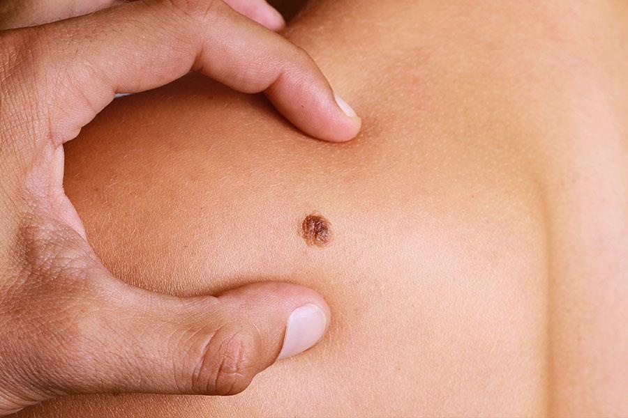 Van de suc khoe khi nang nong anh 2