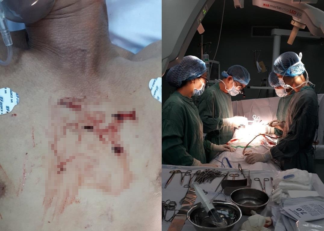 Cứu sống bệnh nhân bị đâm ảnh 1 Cuu song benh nhan bi dam anh 1