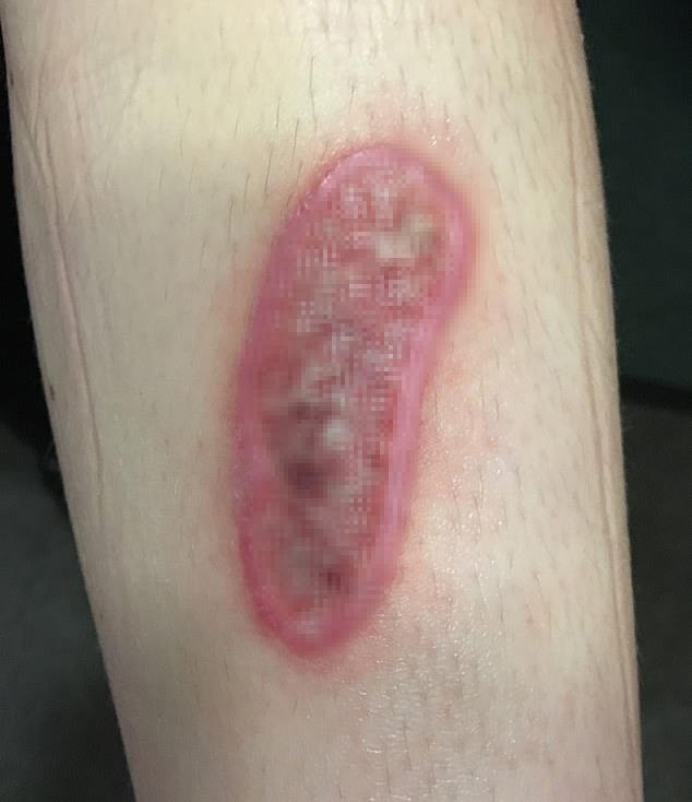 Bong do 3 do keo dan mong tay anh 1