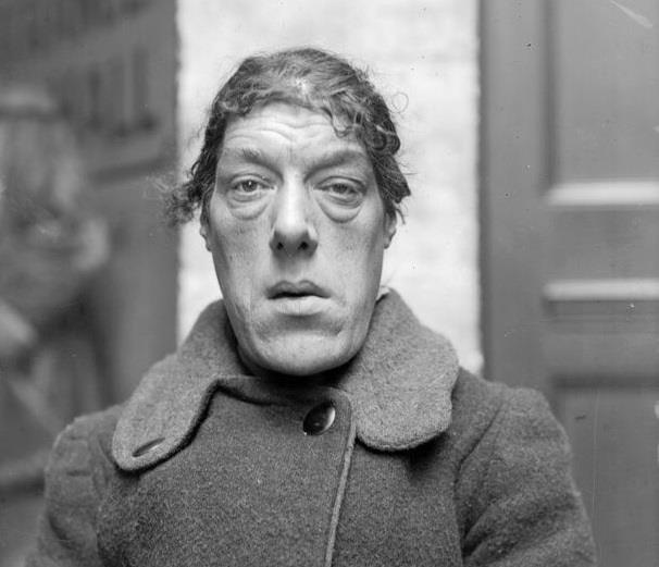 Nguoi phu nu xau nhat the gioi ban 'nhan sac' de nuoi 4 dua con hinh anh