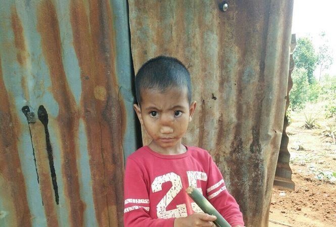 não thoát xuống mũi  ảnh 1 nao thoat xuong mui anh 1