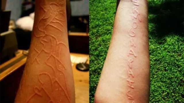 Co gai co so thich viet chu len da anh 1