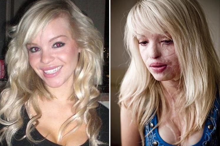 Nguoi mau bi tat axit anh 1