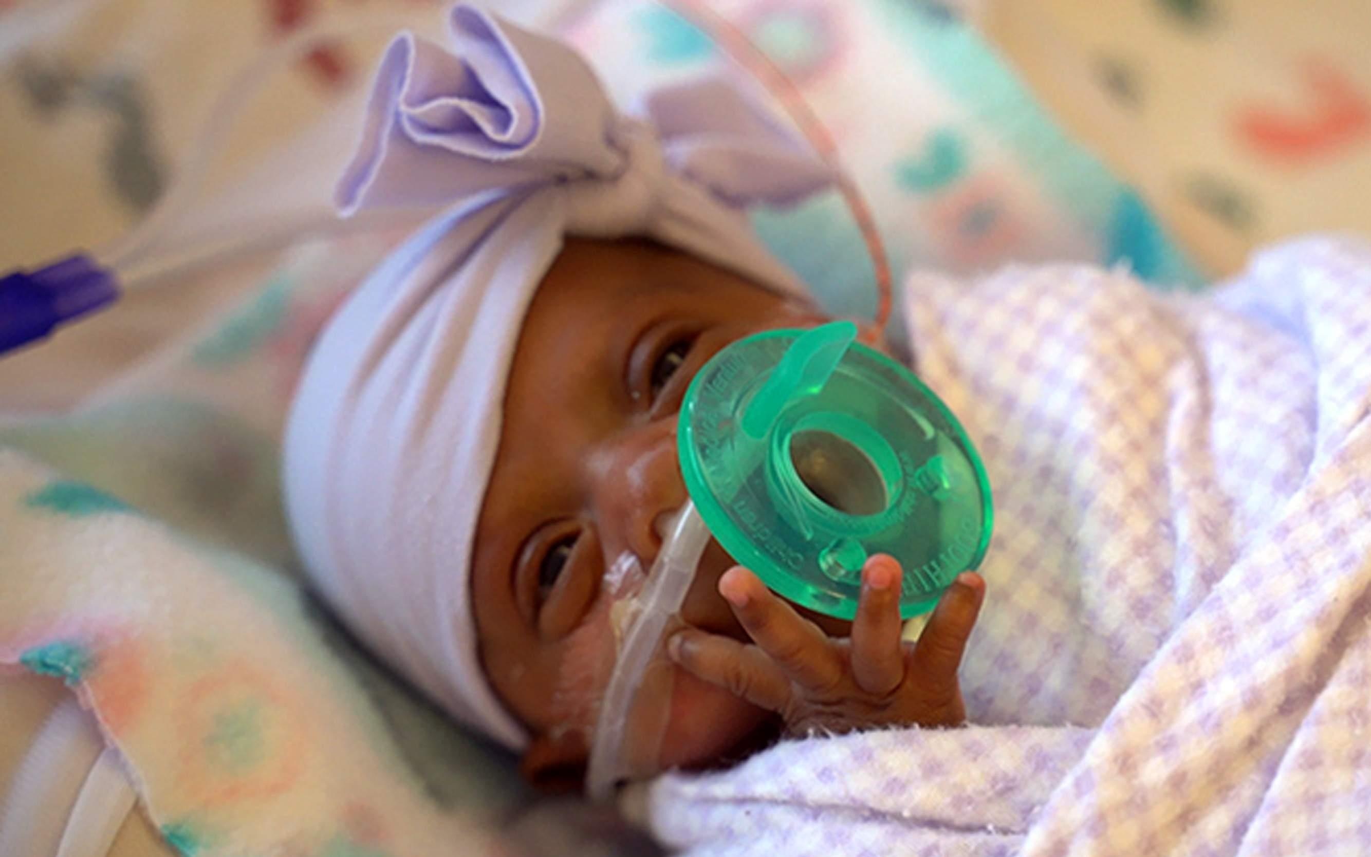 Be gai so sinh nho nhat the gioi duoc xuat vien hinh anh