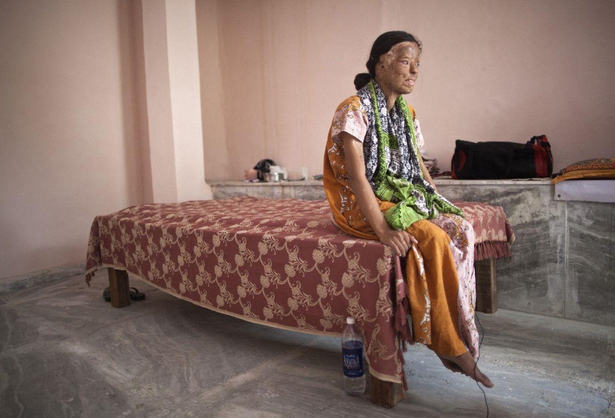 Co gai bi tat axit vi tu choi loi cau hon anh 2