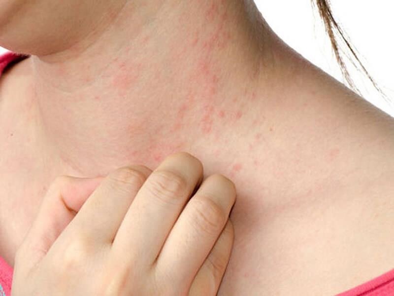 Lot da toan than vi tu chua benh anh 1