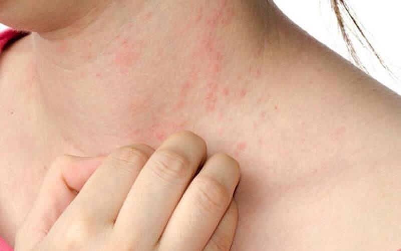 Tu tam nuoc la, cung bai chua benh, mot phu nu bi lot da toan than hinh anh