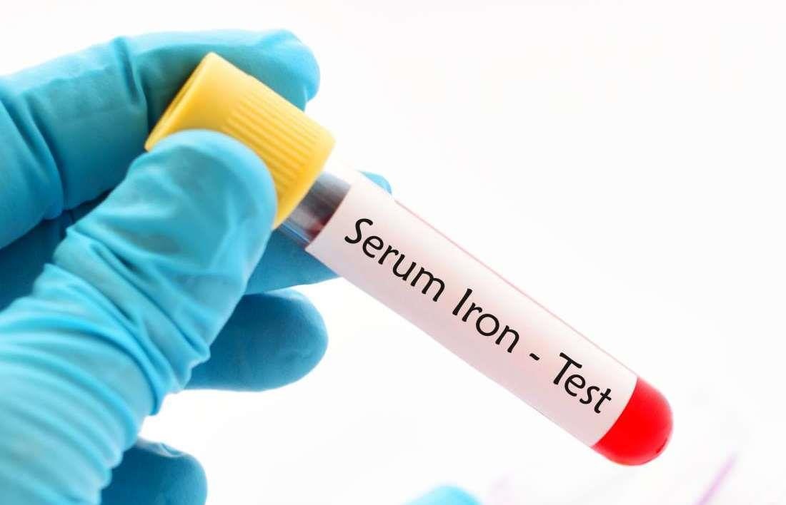 Nhom mau hiem nhat the gioi anh 10