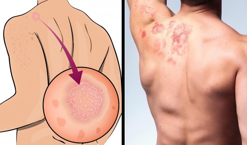 Co the khi khong tam rua anh 1