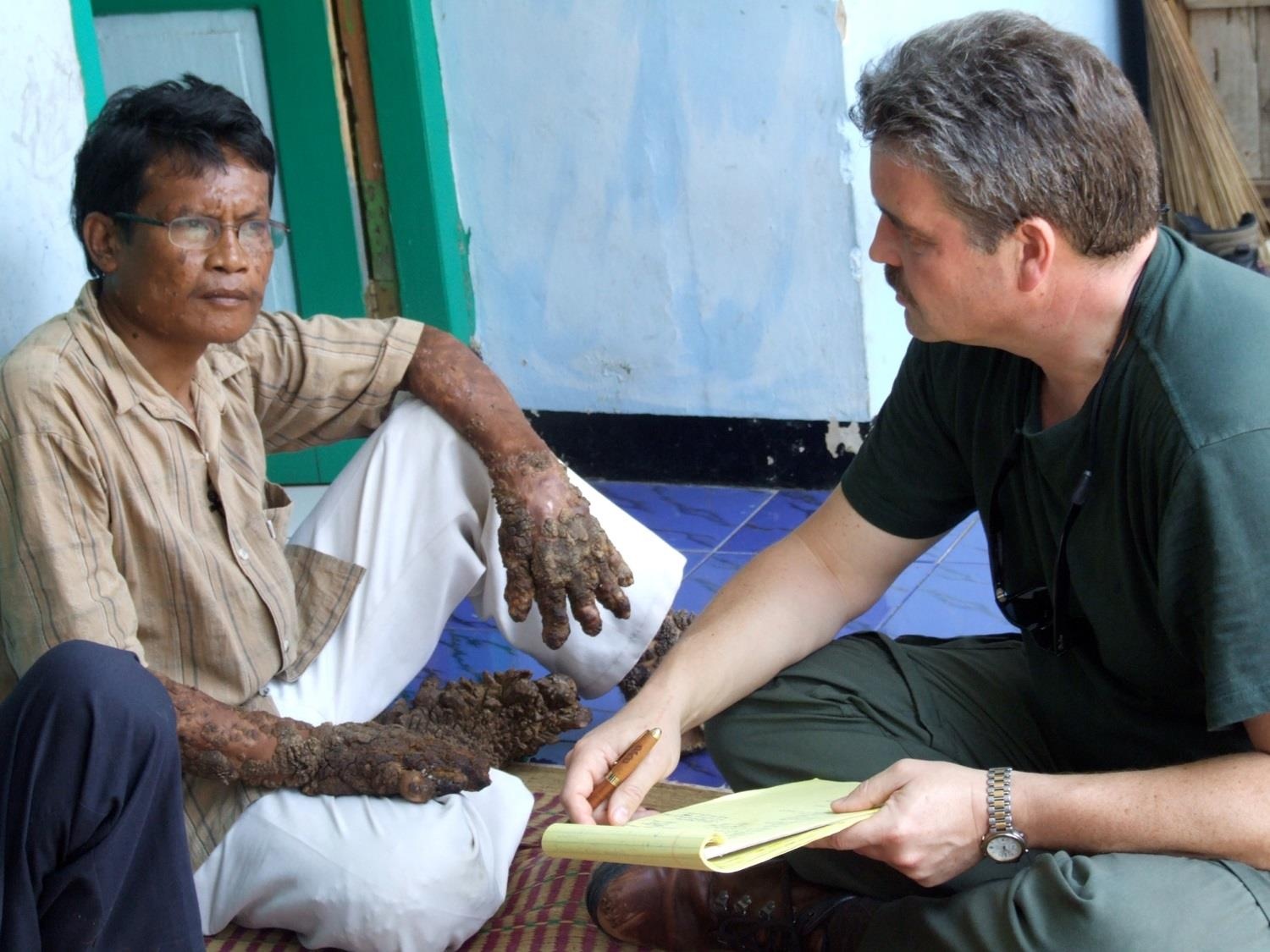 benh nguoi cay anh 7