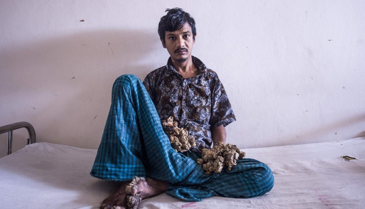 Cuoc song cua "nguoi cay" anh 10