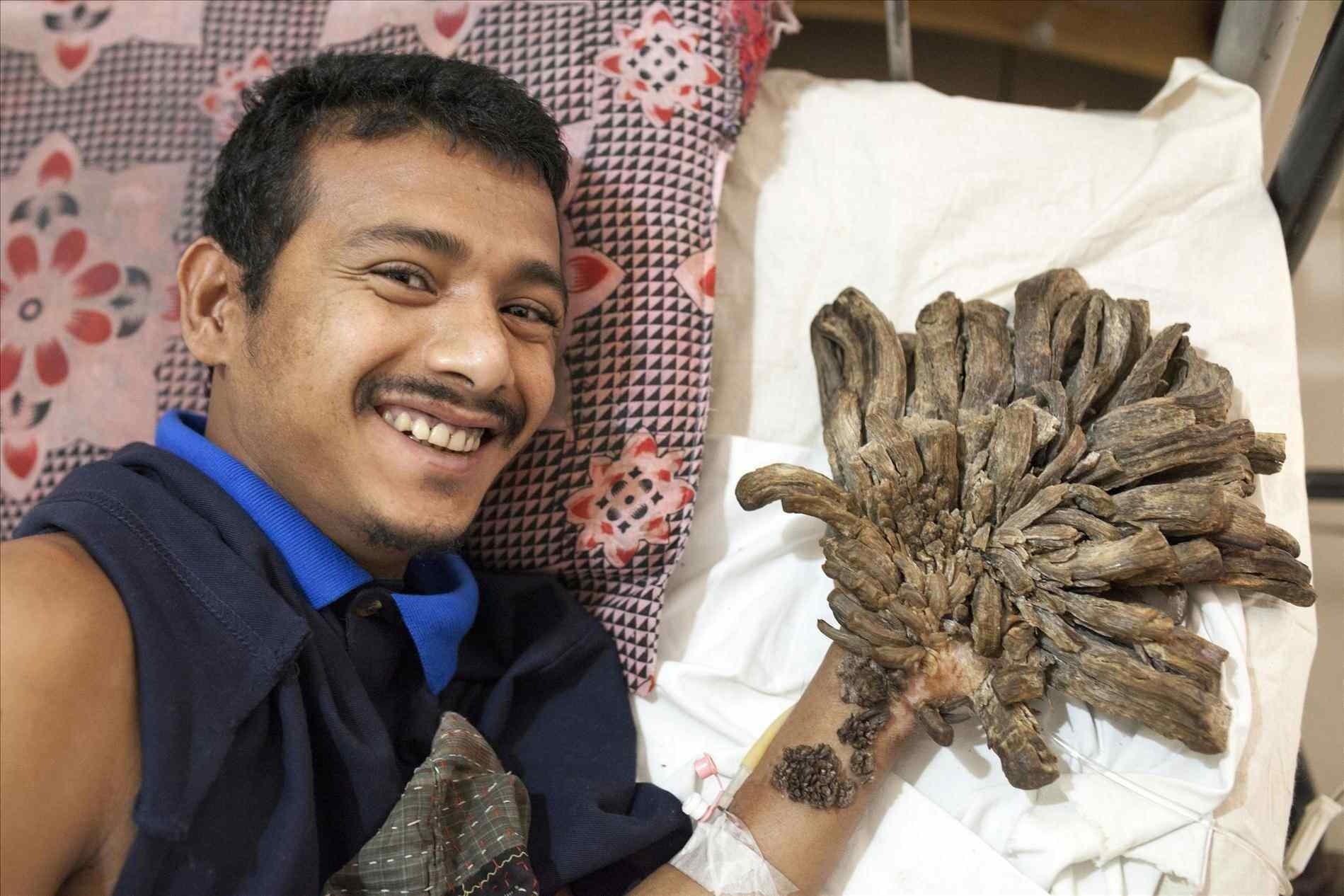 Cuoc song cua "nguoi cay" anh 2