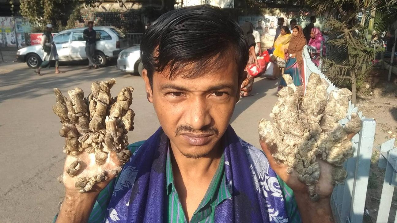 Cuoc song cua "nguoi cay" anh 5