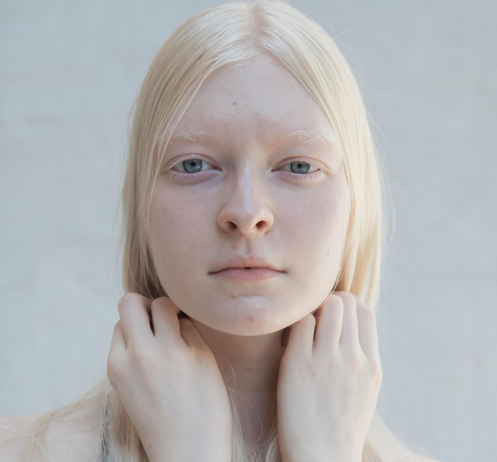 Nguoi mac chung bach tang anh 4