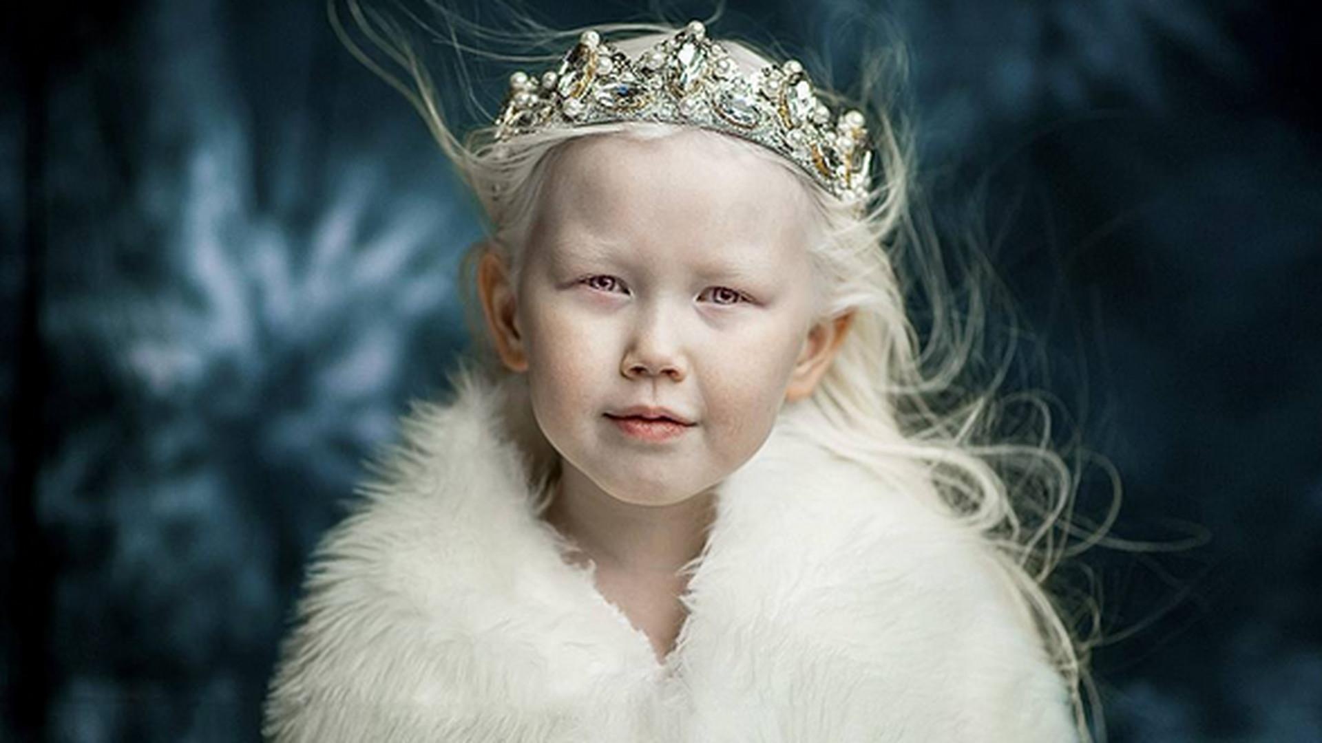 Nguoi mac chung bach tang anh 7