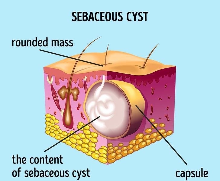 Van de suc khoe o nu gioi anh 4