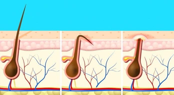 Van de suc khoe o nu gioi anh 7